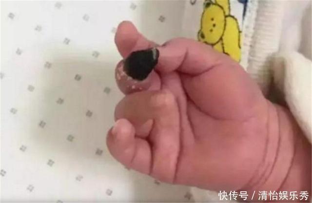 宝宝|6个月宝宝总哭闹,妈妈送医检查却被责骂,因宝妈太粗心害了孩子