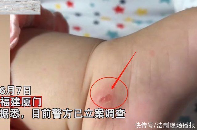 宝妈|4个月大的女婴超市内遭陌生大妈狠掐，婴儿脚被掐掉一块皮