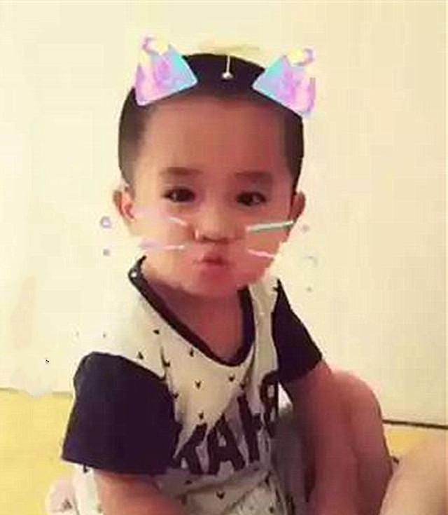 产后抑郁症|5年前因吃奶太用力,被妈妈划成“花猫脸”的男婴,现如今怎样了?