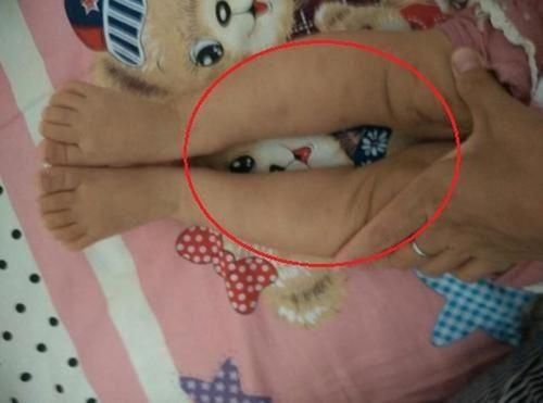 为什么中国孩子那么多“罗圈腿”，外国却很少，只因家长这些行为