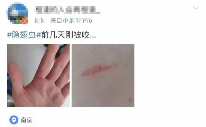 毁容|又是它!女子半夜关灯玩手机,差点致毁容!