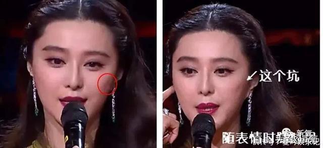 半个娱乐圈女明星脸上都有的这个坑，真的是线雕的锅吗？