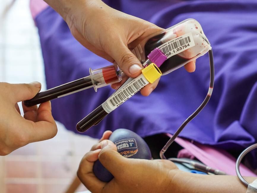 坏脂蛋白|107岁老人,年轻像57岁,长寿秘诀不是少吃肉,而是3件事