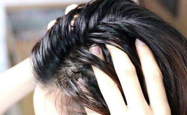 维生素b|头发油腻太邋遢,学会这3招,让你摆脱油头,头发蓬松又柔顺