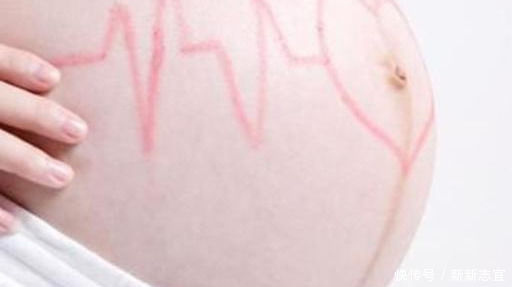 皮肤|怀孕后,孕妈若有3种表现,恭喜,可能爸妈迎来的是“小公主”