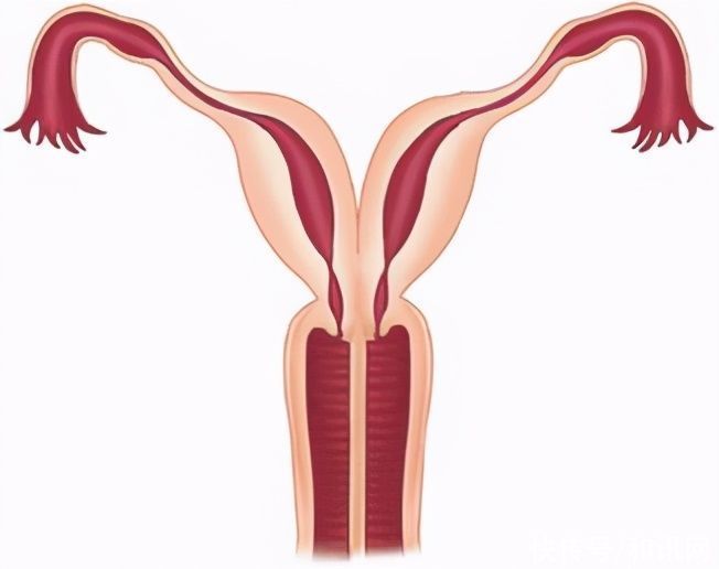 子宫|18岁少女有两个子宫?一月流两次血