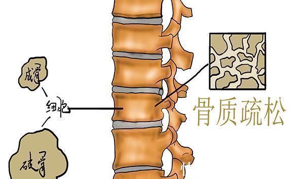 骨骼|增强骨密度的高手,其实不是牛奶,经常吃,骨量增加,骨骼更强健