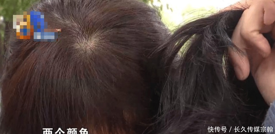 女子去染头发,本想美美地过新年,没想到却染得像戴了假发?