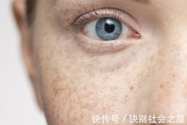 肝毒|脸上这3种表现，是肝脏毒素太多的表现！简单3招，给肝脏排毒