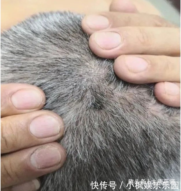 神农本草经|一个爷爷留下来的土偏方!一分钱不花,治好瘊子,效果真的好!