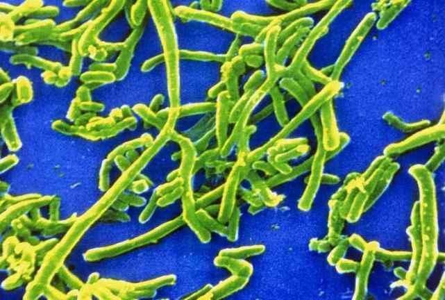 经常“大便粘马桶”是怎么回事不是湿气重,而是这种问题