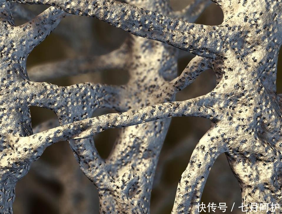 42岁男子常吃鸡蛋查出骨质疏松,医生:除了鸡蛋,2物也很伤骨