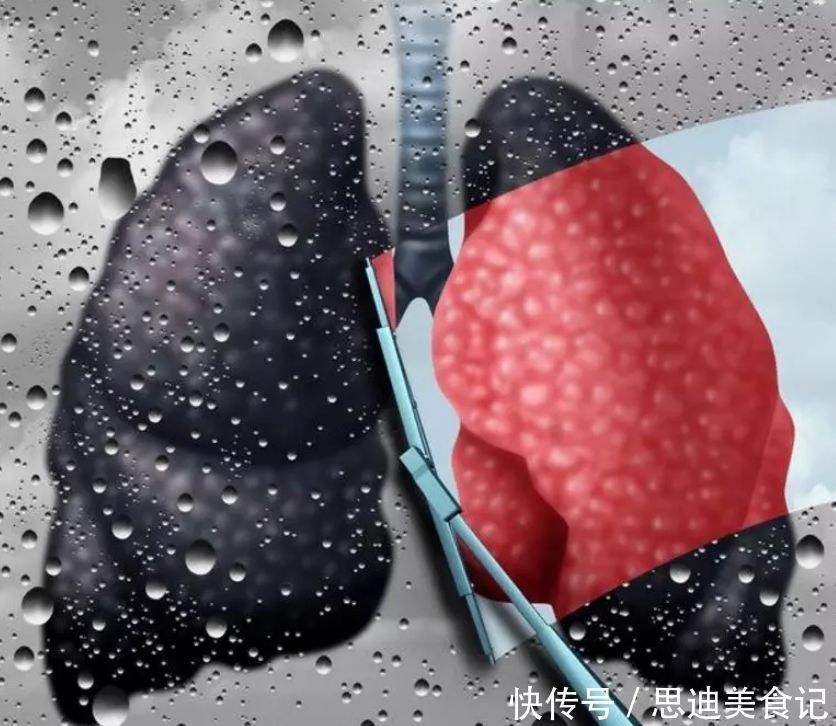 45岁后,想长寿,身体3处越“干净”, 寿命越长,越早知越好