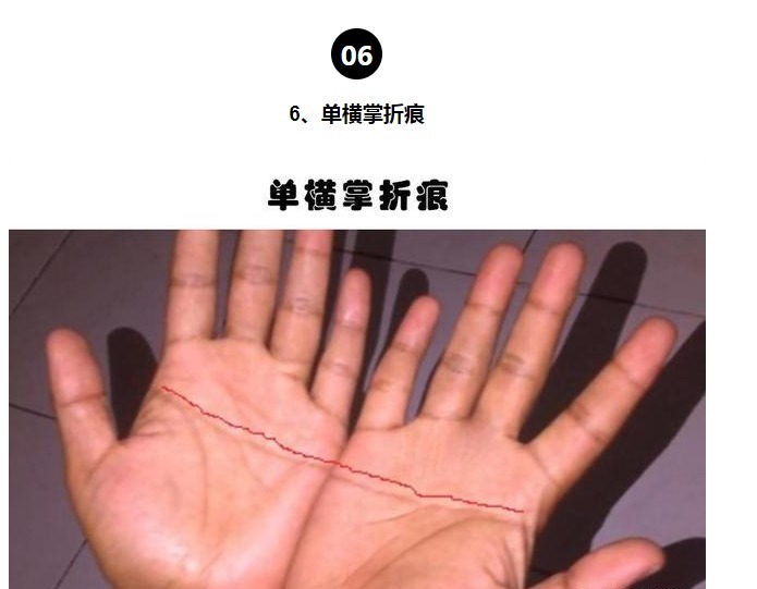 等位基因|罕见的身体特征只有少数人身上才拥有的10个罕见的特征