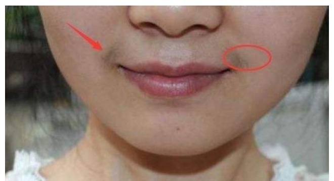 黑眼圈|女性有没有妇科病,看脸就知道!希望你没有这4个表现!