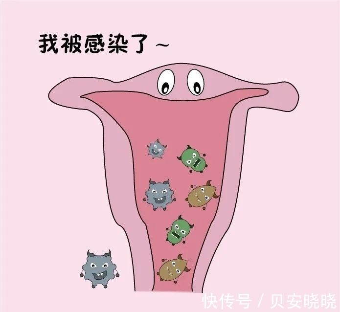 用药|贝安健康:如何治疗滴虫性阴道炎?