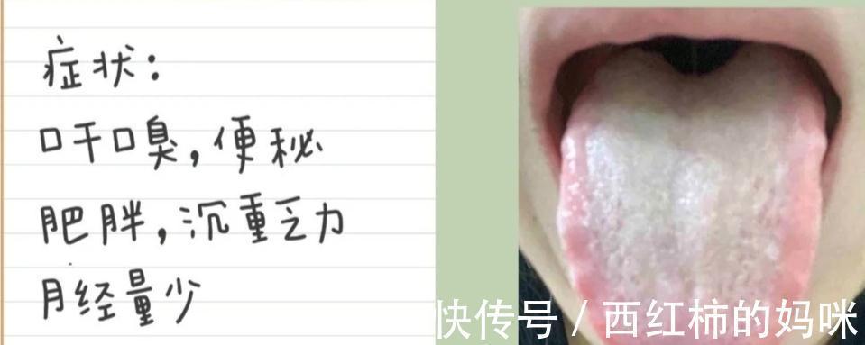 大便|便秘、大便先干后稀、大便溏稀不成型、羊屎便都是怎么回事？