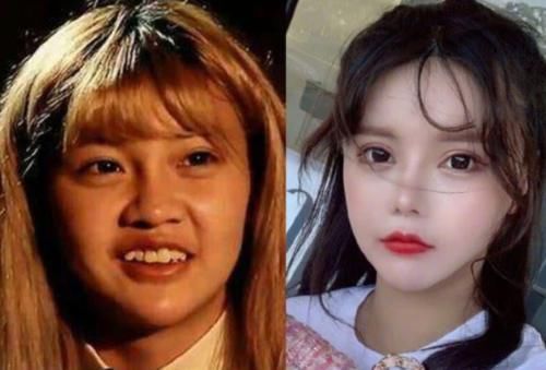 面部|22岁韩安冉面部下垂，多次修复鼻子再无法动刀，越整越像“僵尸脸”