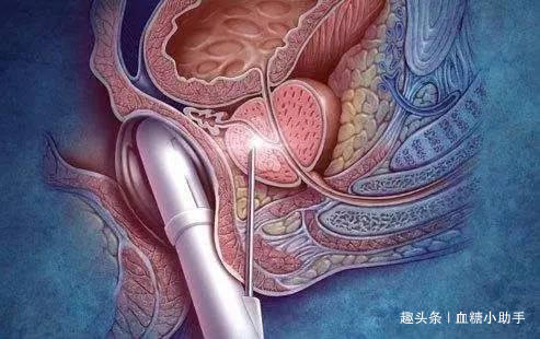 十字花科|医学专家提醒男人掌握5个促睾法，让你越来越有魅力