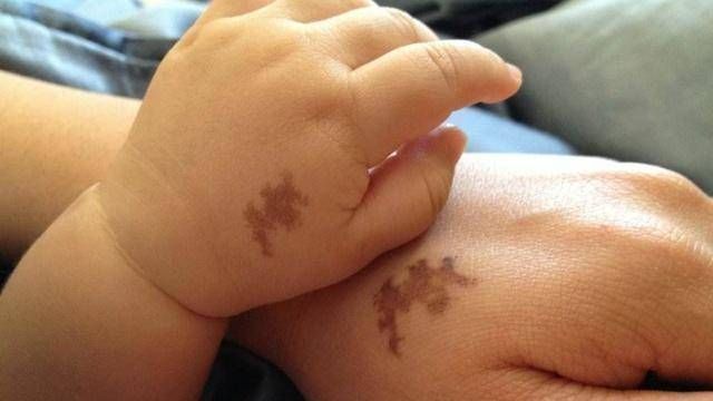 怀孕期|怀孕期间准妈妈这样做，会容易在宝宝身上留下“胎记”