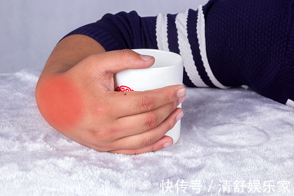 海鲜|尿酸高“嘌呤大户”已被揪出来了,不是海鲜,平时再喜欢也少碰