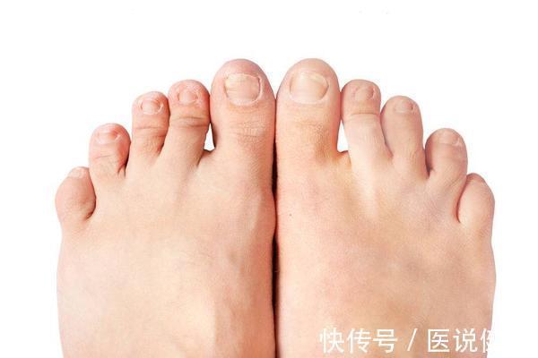 手脚冰凉|女人气血不足时,身体或有这6个表现,若你都符合,要及时调理