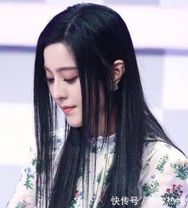 脱发|Tony老师私下透露,发际线“告急”,可能是常年这3种发型引起的!