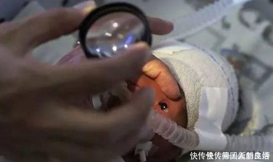 筛查|近视孩子竟被割手治疗，如何判断宝宝视力是否异常