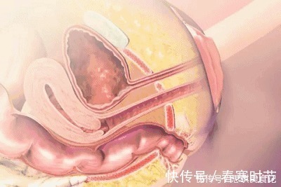 宝宝|生孩子到底有多痛?10张图告诉你:宝宝如何一步步来到这个世界