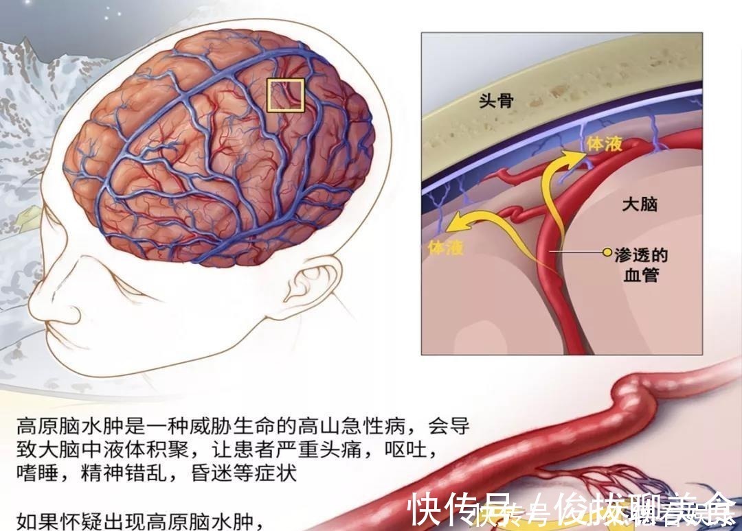 海拔|为什么说高反是纸老虎？ 中国自驾地理