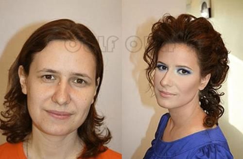 全脸埋线多久恢复自然、线雕恢复期是多久