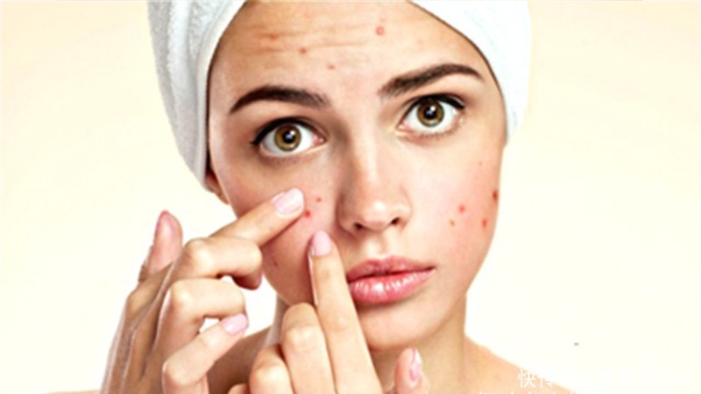 遮瑕膏|长痘痘能化妆吗?不行,但要见重要客户,不化妆不行啊,怎么办?