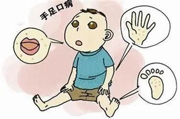 防护|手足口病高发期！做好这些事情，让孩子的防护力加倍