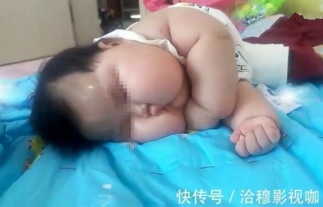 下肢|几个月大的婴儿,被活生生喂成一颗“肉球”,父母反而洋洋得意