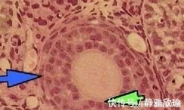 助孕|30岁的我卵巢一步步衰退,最后选择试管婴儿助孕