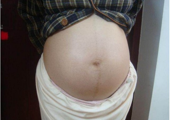 产检|做二胎产检时带大女儿,女儿说的话,在场所有医生都懵住了