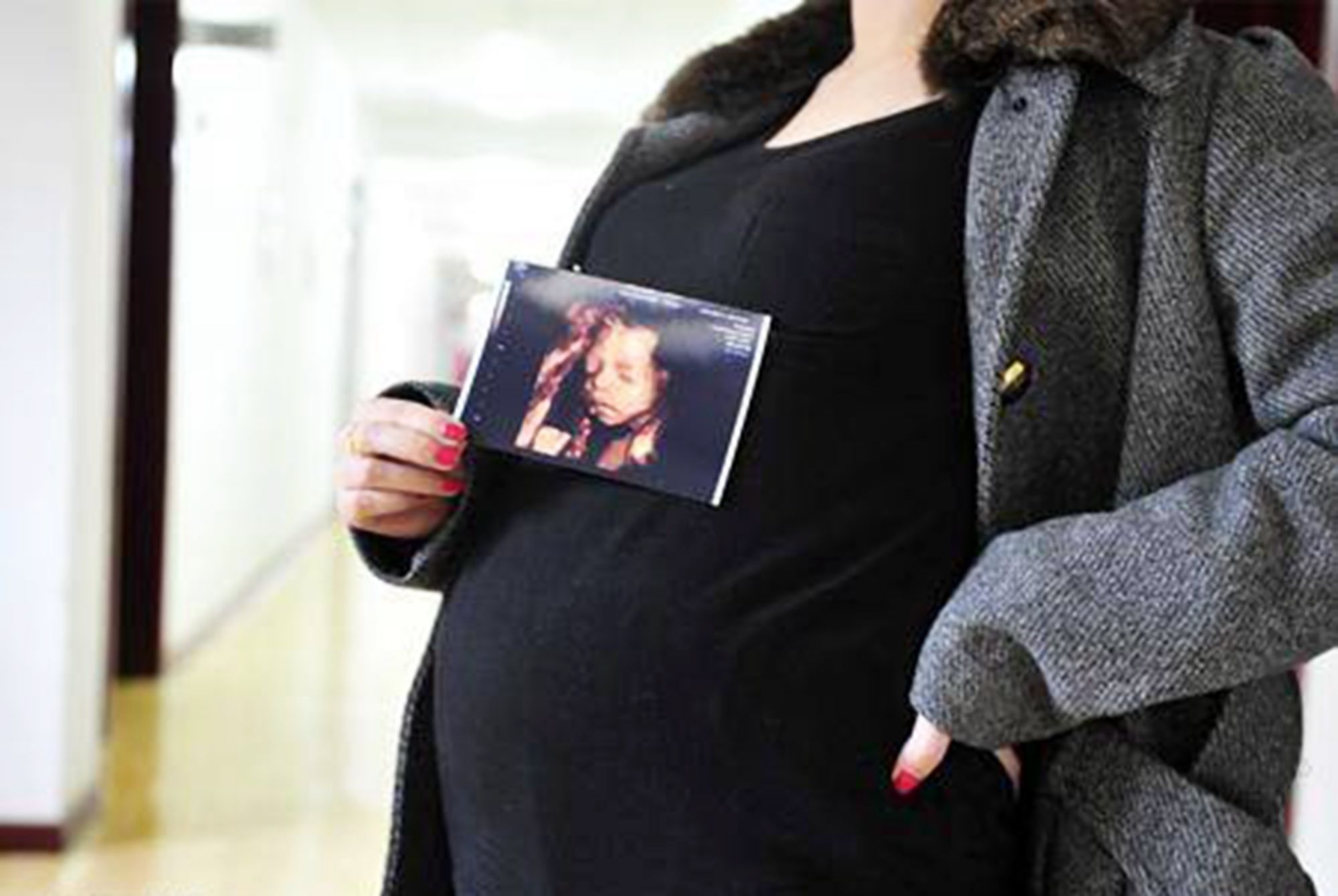 四维彩超|产检做四维彩超,为什么“家属勿入”?其实是出于“三保护”原则