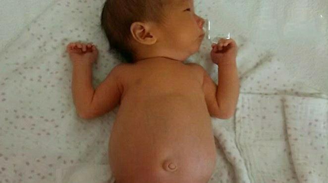 奶量|宝宝出现这6个表现,说明过度喂养了!快停手!