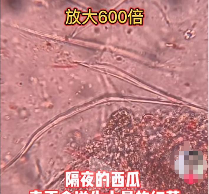 荔枝病|夏天养娃,家长远离这几个禁区,孩子才会少生病才能“长高个”