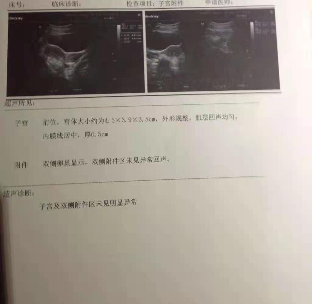 张女士|神奇的桂枝茯苓丸，治好了困扰多年的子宫肌瘤