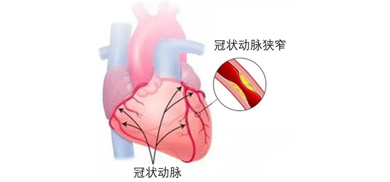 肠溶片|阿司匹林、硝酸甘油、速效救心丸，急救时用哪种？