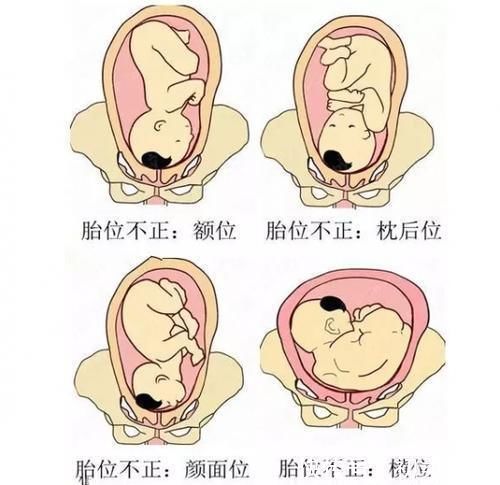 胎儿|孕妇生下“白雪公主”，医生吓出冷汗胎儿的血竟被妈妈“吸走”