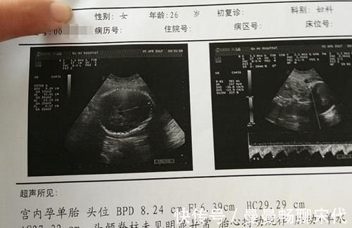 智力|新生儿越重,说明智商越高?错,接近这个数字宝宝发育才更好