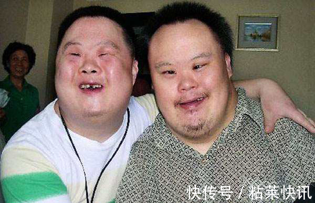 唐氏综合症日|世界唐氏综合症日关注被遗忘的天使,“唐宝宝”如何健康长大