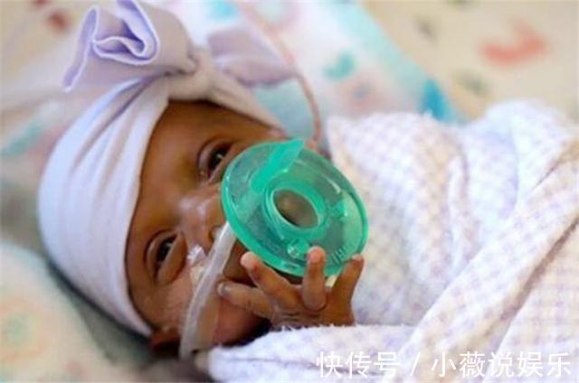 孕妇|世界上最小的婴儿宝宝,身长同一支钢笔,如今过得怎么样?