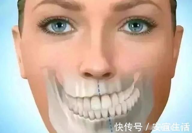 畸形|父母請注意：孩子12歲之前必須矯正的幾種牙齒畸形