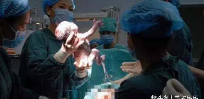 妈妈|产道这么狭窄胎儿是咋出来的?除了皮肤弹性,胎儿的努力令人动容