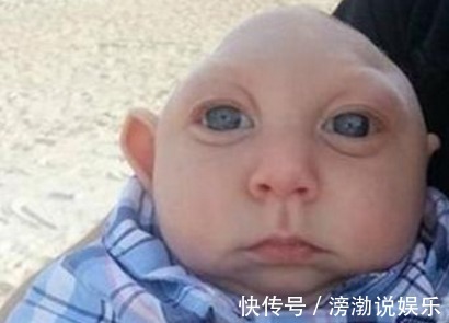 生活环境|怀孕20周,四维彩超却发现胎儿畸形,闻到孕妇身上的味道明白了