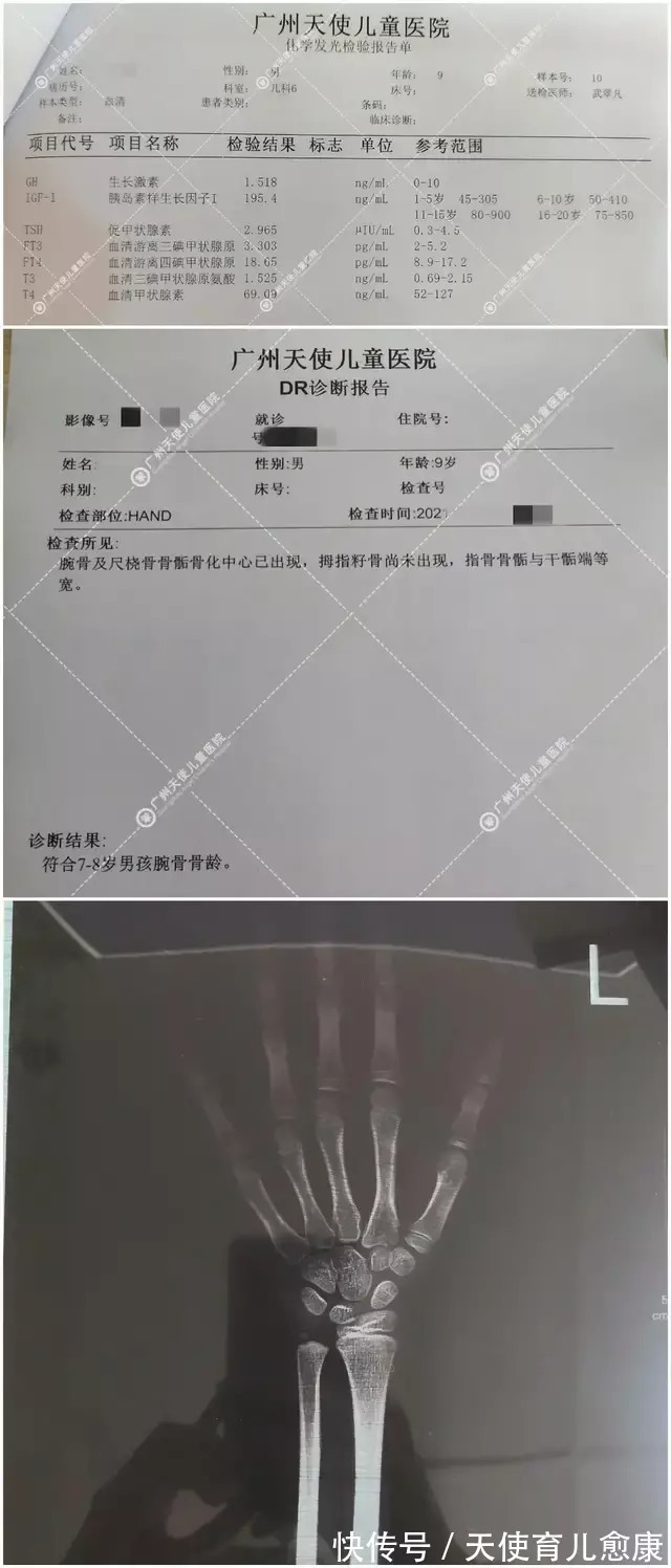 矮小症|两个月成功增高1.5㎝!9岁矮小男孩“追赶”人生