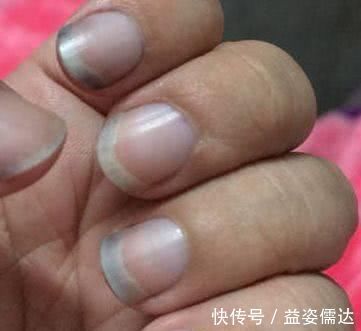 三阴交|肝脏干净的女人，一般会有这3个“表现”，你若全有，真心不错